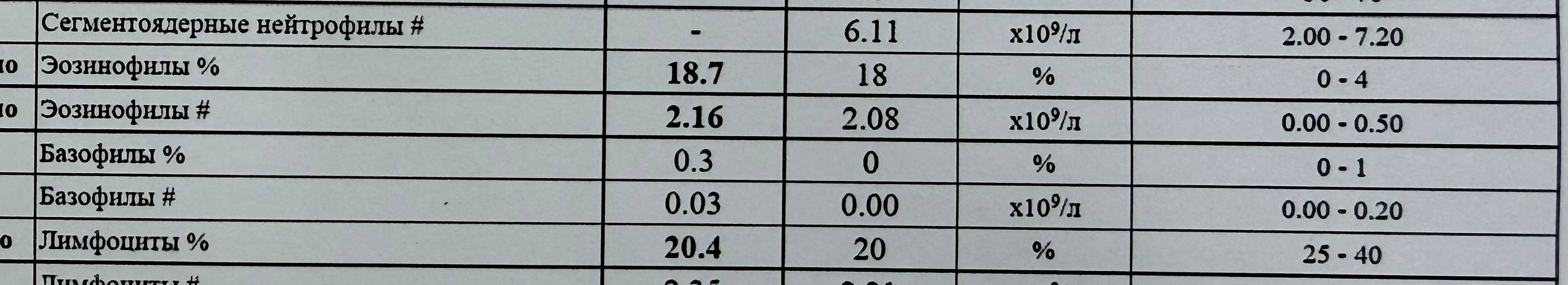 Фрагмент общего анализа крови: эозинофилы повышены до 18,7 процента и 2,16 на 10 в девятой степени на литр